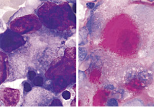 図7　骨髄　（左）MG染色 （右）PAS染色