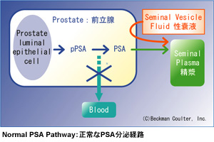 Normal PSA Pathway�F�����PSA����o�H