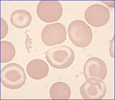 http://www.beckmancoulter.co.jp/images/hematology/oneself/part02/self2_34.jpg