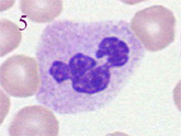 85