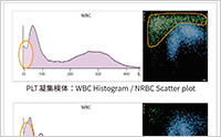 血球計数におけるNRBC測定（2）