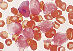 図1　末梢血　NAP染色