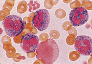 図2　末梢血　NAP染色