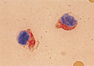 図2　末梢血　β-GI染色