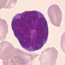 case1
