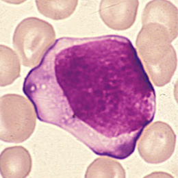 case5