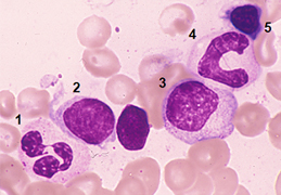 case1