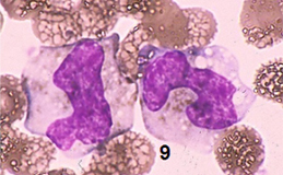 case2