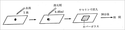 鎌状赤血球形成試験