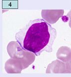 「ネットで形態」　血液形態自習塾 第2部
 末梢血・骨髄像の見方&考え方