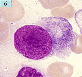 「ネットで形態」 血液形態自習塾 第2部 末梢血・骨髄像の見方&考え方/ベックマン・コールター